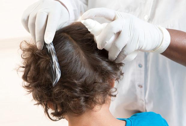 The best remedies for lice and nits